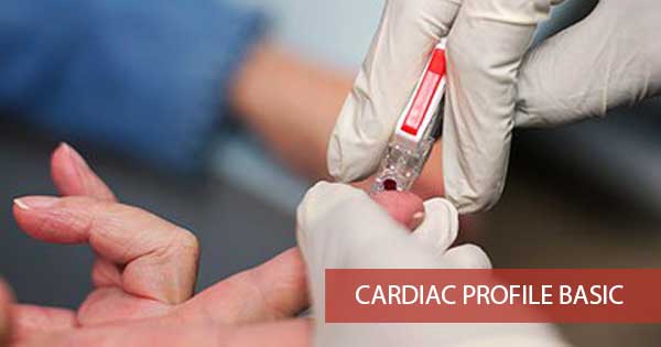 Cardiac Profile Basic