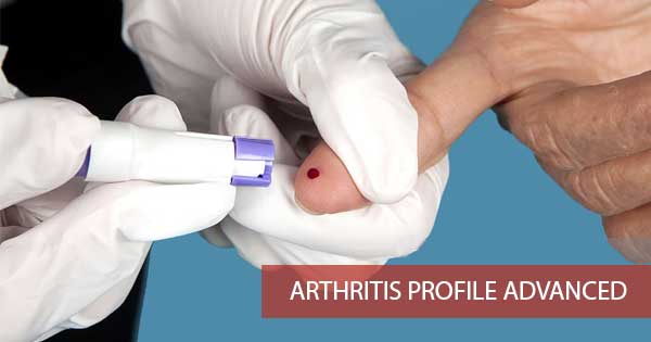 Arthritis Profile Advanced