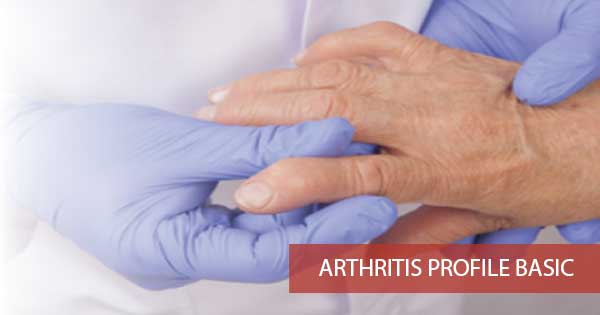 Arthritis Profile Test Basic