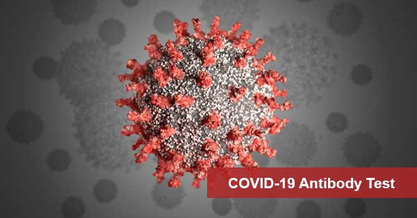 COVID-19 Antibody IgG Test