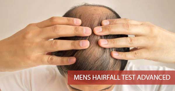 Mens Hair Fall Test Advanced